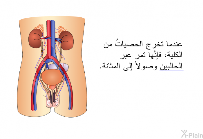 عندما تخرج الحصياتُ من الكلية، فإنَّها تمر عبر الحالبين وصولاً إلى المثانة.