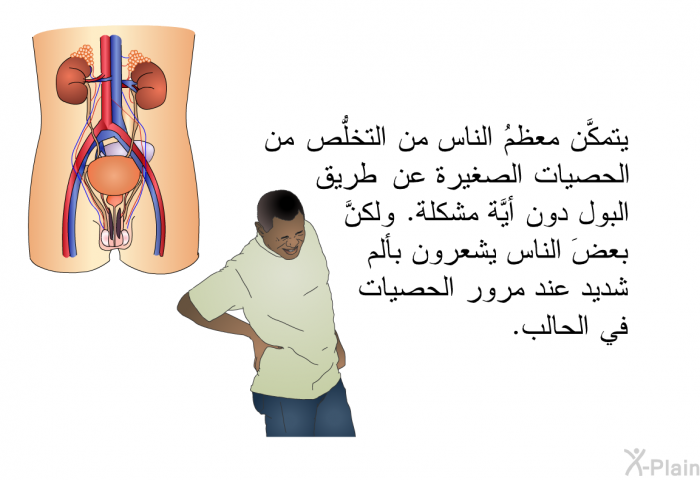 يتمكَّن معظمُ الناس من التخلُّص من الحصيات الصغيرة عن طريق البول دون أيَّة مشكلة. ولكنَّ بعضَ الناس يشعرون بألم شديد عند مرور الحصيات في الحالب.