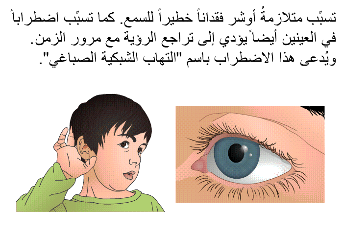 تسبِّب متلازمةُ أوشر فقداناً خطيراً للسمع. كما تسبِّب اضطراباً في العينين أيضاً يؤدي إلى تراجع الرؤية مع مرور الزمن. ويُدعى هذا الاضطراب باسم "التهاب الشبكية الصباغي".
