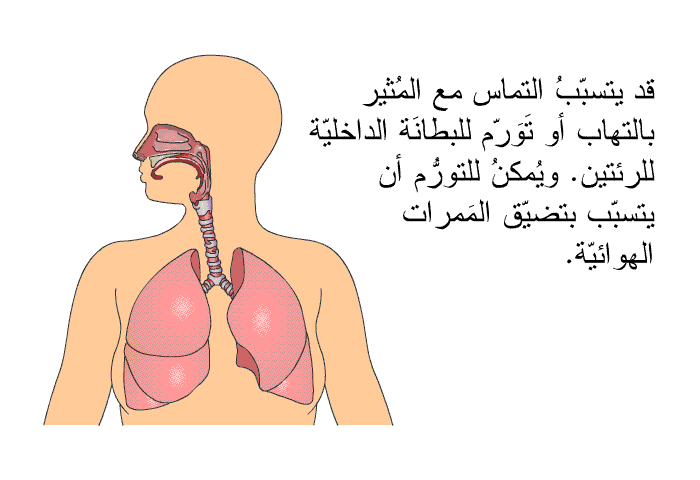 قد يتسبّبُ التماس مع المُثير بالتهاب أو تَوَرّم للبطانَة الداخليّة للرئتين. ويُمكنُ للتورُّم أن يتسبّب بتضيّق المَمرات الهوائيّة.