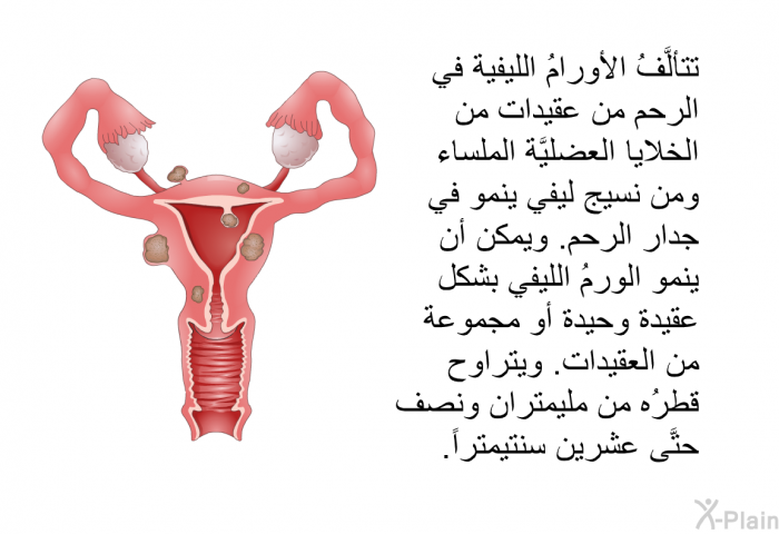 تتألَّفُ الأورامُ الليفية في الرحم من عقيدات من الخلايا العضليَّة الملساء ومن نسيج ليفي ينمو في جدار الرحم. ويمكن أن ينمو الورمُ الليفي بشكل عقيدة وحيدة أو مجموعة من العقيدات. ويتراوح قطرُه من مليمتران ونصف حتَّى عشرين سنتيمتراً.