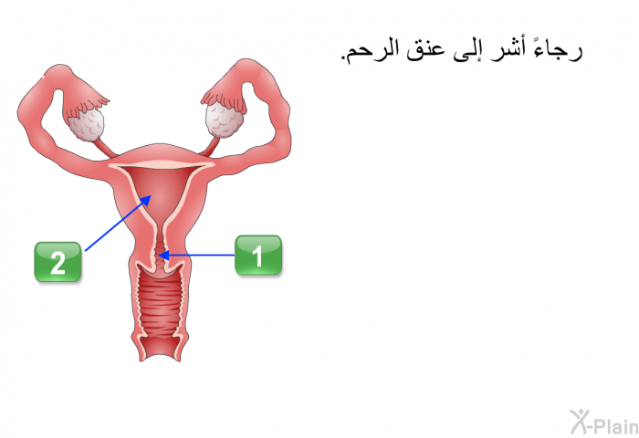 رجاءً أشر إلى عنق الرحم.