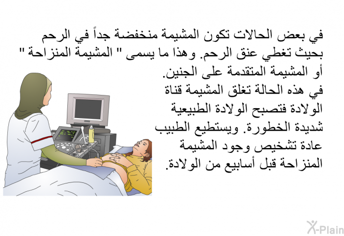 في بعض الحالات تكون المشيمة منخفضة جداً في الرحم بحيث تغطي عنق الرحم. وهذا ما يسمى " المشيمة المنزاحة" أو المشيمة المتقدمة على الجنين. في هذه الحالة تغلق المشيمة قناة الولادة فتصبح الولادة الطبيعية شديدة الخطورة. ويستطيع الطبيب عادة تشخيص وجود المشيمة المنزاحة قبل أسابيع من الولادة.