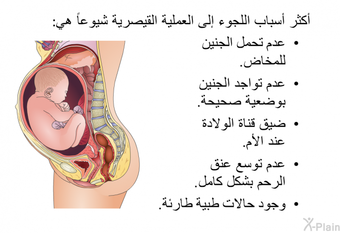 أكثر أسباب اللجوء إلى العملية القيصرية شيوعاً هي:  عدم تحمل الجنين للمخاض. عدم تواجد الجنين بوضعية صحيحة. ضيق قناة الولادة عند الأم. عدم توسع عنق الرحم بشكل كامل. وجود حالات طبية طارئة.