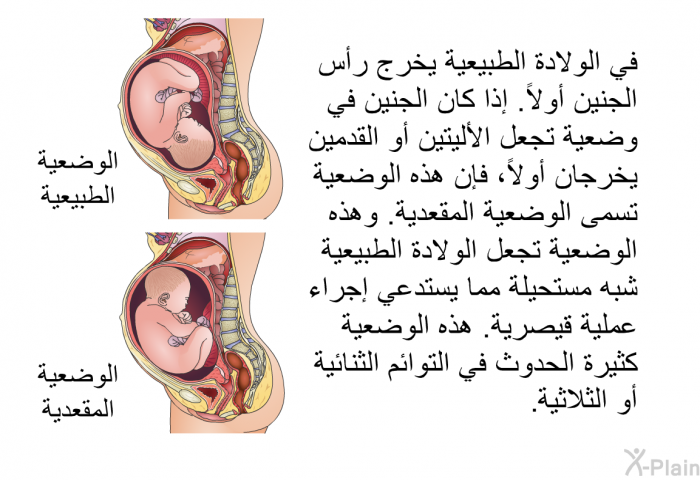 في الولادة الطبيعية يخرج رأس الجنين أولاً. إذا كان الجنين في وضعية تجعل الأليتين أو القدمين يخرجان أولاً، فإن هذه الوضعية تسمى الوضعية المقعدية. وهذه الوضعية تجعل الولادة الطبيعية شبه مستحيلة مما يستدعي إجراء عملية قيصرية. هذه الوضعية كثيرة الحدوث في التوائم الثنائية أو الثلاثية.