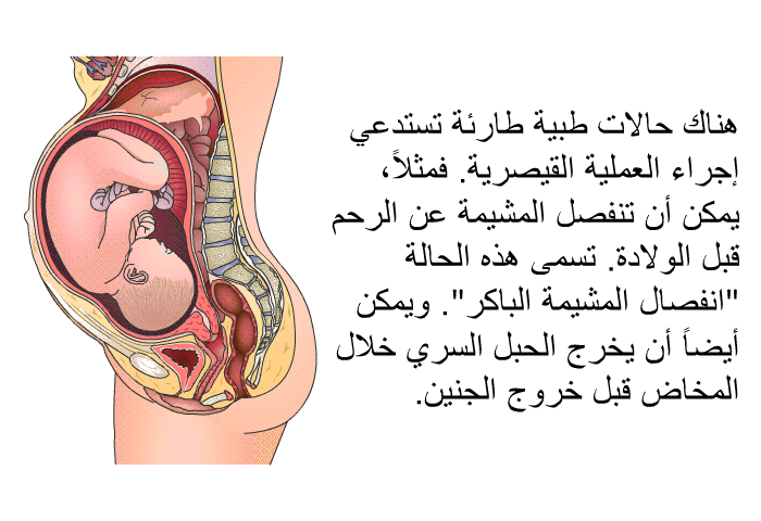 هناك حالات طبية طارئة تستدعي إجراء العملية القيصرية. فمثلاً، يمكن أن تنفصل المشيمة عن الرحم قبل الولادة. تسمى هذه الحالة "انفصال المشيمة الباكر". ويمكن أيضاً أن يخرج الحبل السري خلال المخاض قبل خروج الجنين.