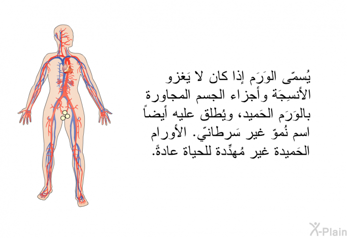 يُسمّى الوَرَم إذا كان لا يَغزو الأنسِجَة وأجزاء الجسم المجاورة بالوَرَم الحَميد، ويُطلق عليه أيضاً اسم نُموّ غير سَرطانيّ. الأورام الحَميدة غير مُهدِّدة للحياة عادةً.