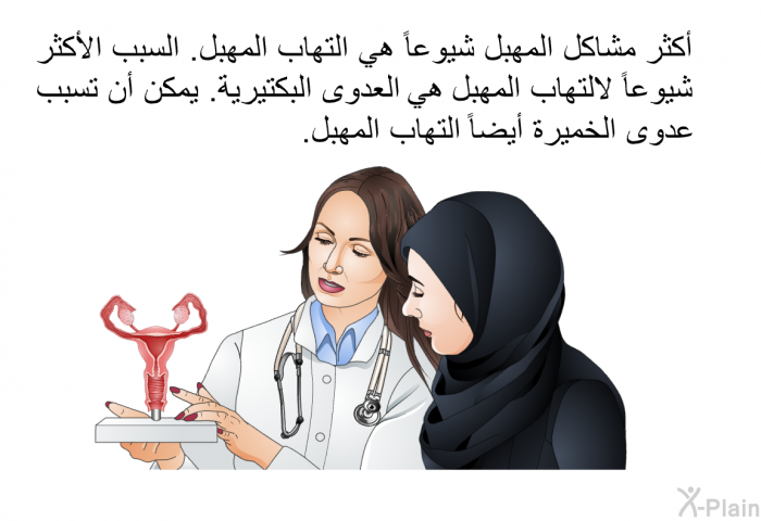 أكثر مشاكل المهبل شيوعًا هي التهاب المهبل. السبب الأكثر شيوعًا لالتهاب المهبل هو العدوى البكتيرية. يمكن أن تسبب عدوى الخميرة أيضًا التهاب المهبل.