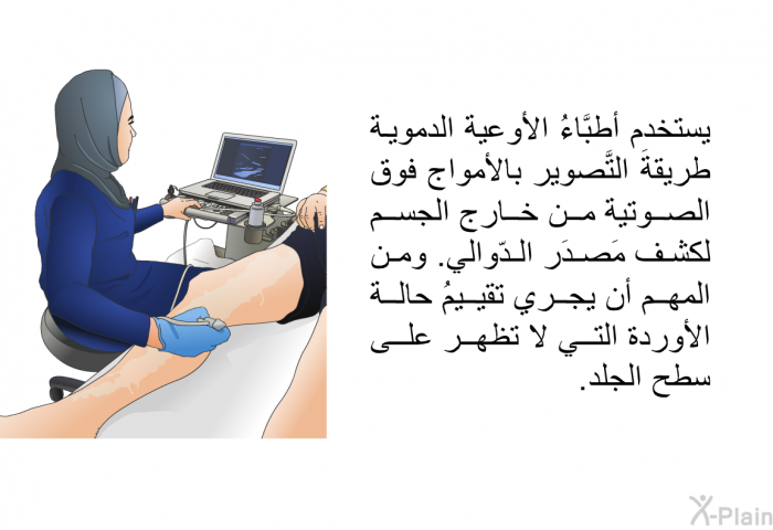 يستخدم أطبَّاءُ الأوعية الدموية طريقةَ التَّصوير بالأمواج فوق الصوتية من خارج الجسم لكشف مَصدَر الدّوالي<B>. </B>ومن المهم أن يجري تقييمُ حالة الأوردة التي لا تظهر على سطح الجلد<B>. </B>