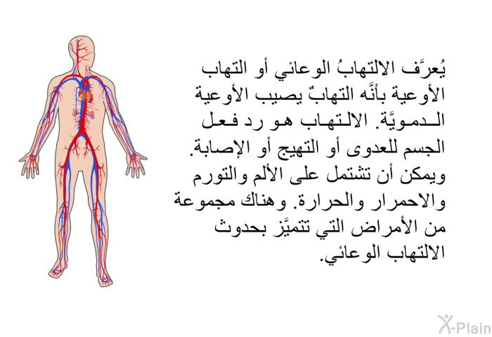 يُعرَّف الالتهابُ الوعائي أو التهاب الأوعية بأنَّه التهابٌ يصيب الأوعية الدمويَّة. الالتهاب هو رد فعل الجسم للعدوى أو التهيج أو الإصابة. ويمكن أن تشتمل على الألم والتورم والاحمرار والحرارة. وهناك مجموعة من الأمراض التي تتميَّز بحدوث الالتهاب الوعائيِّ.