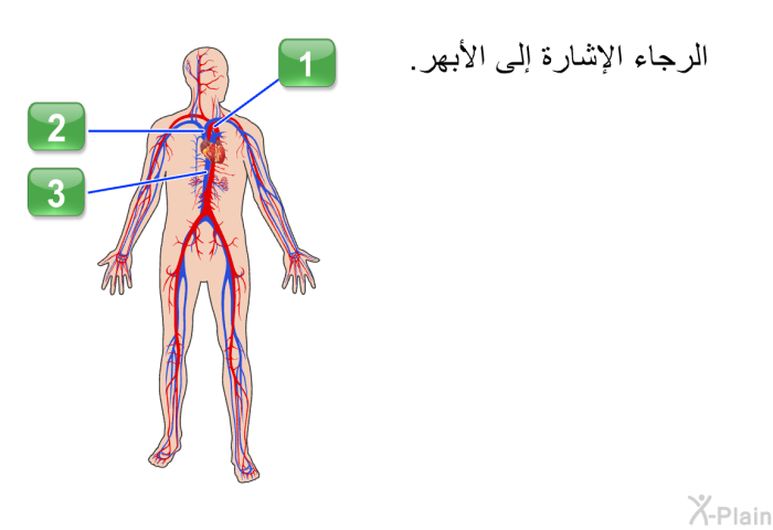 الرجاء الإشارة إلى الأبهر.