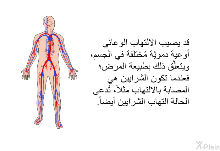 قد يصيب الالتهابُ الوعائيُّ أوعيةً دمويَّة مُختلفة في الجسم، ويتعلَّق ذلك بطبيعة المرض؛ فعندما تكون الشرايين هي المُصابة بالالتهاب مثلاً، تُدعى الحالة التهاب الشرايين أيضاً.