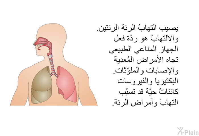 يصيب التهابُ الرئة الرئتين. والالتهابُ هو ردَّة فعل الجهاز المناعي الطبيعي تجاه الأمراض المُعدِية والإصابات والملوِّثات. البكتيريا والفيروسات كائناتٌ حيَّة قد تسبِّب التهابَ وأمراض الرئة.