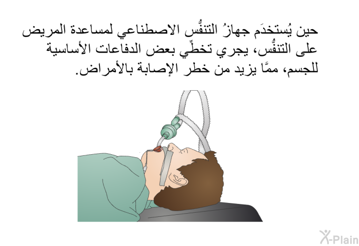 حين يُستخدَم جهازُ التنفُّس الاصطناعي لمساعدة المريض على التنفُّس، يجري تخطِّي بعض الدفاعات الأساسية للجسم، ممَّا يزيد من خطر الإصابة بالأمراض.