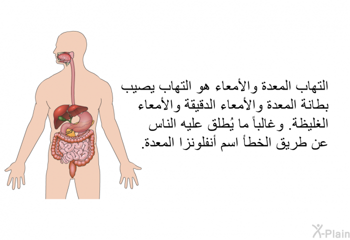 التهاب المعدة والأمعاء هو التهاب يصيب بطانة المعدة والأمعاء الدقيقة والأمعاء الغليظة. وغالباً ما يُطلق عليه الناس عن طريق الخطأ اسم أنفلونزا المعدة.