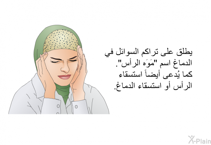 يطلق على تَراكم السوائل في الدِّماغ اسم "مَوَه الرَّأس". كما يُدعى أيضاً استسقاء الرأس أو استسقاء الدِّماغ.