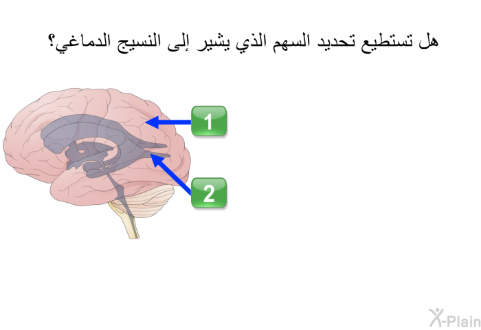 هل تستطيع تحديد السهم الذي يُشير إلى النَّسيج الدِّماغي؟