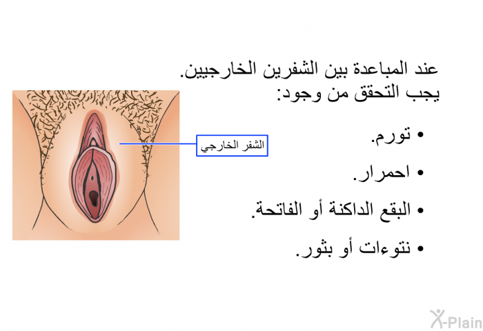 عند المباعدة بين الشفرين الخارجيين. يجب التحقق من وجود:   تورم.  احمرار.    البقع الداكنة أو الفاتحة.   نتوءات أو بثور.