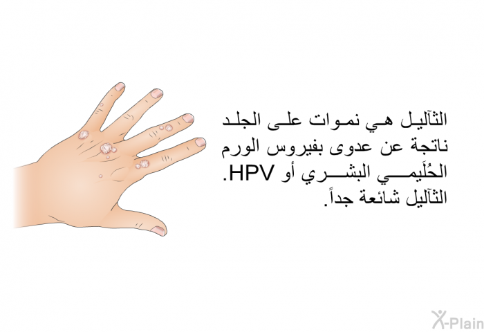الثآليل هي نموات على الجلد ناتجة عن عدوى بفيروس الورم الحُلَيمي البشري أو HPV. الثآليل شائعة جداً.