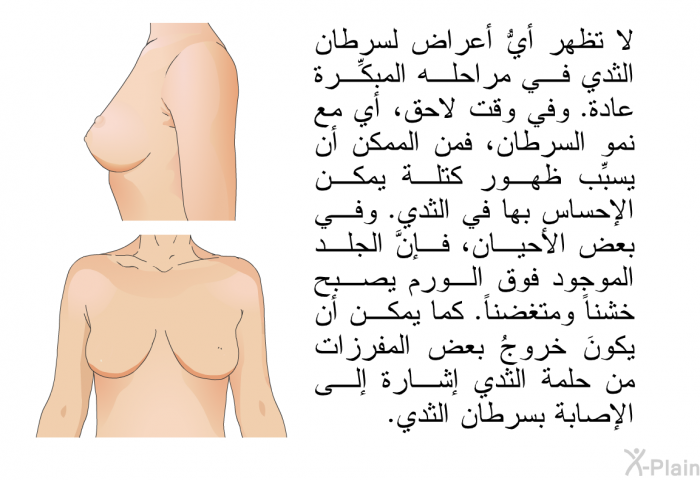 لا تظهر أيُّ أعراض لسرطان الثدي في مراحله المبكِّرة عادة. وفي وقت لاحق، أي مع نمو السرطان، فمن الممكن أن يسبِّب ظهور كتلة يمكن الإحساس بها في الثدي. وفي بعض الأحيان، فإنَّ الجلد الموجود فوق الورم يصبح خشناً ومتغضناً. كما يمكن أن يكونَ خروجُ بعض المفرزات من حلمة الثدي إشارة إلى الإصابة بسرطان الثدي.