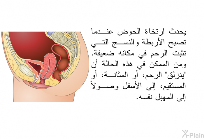 يحدث ارتخاءُ قاع الحوض عندما تصبح الأربطة والنسج التي تثبت الرحم في مكانه ضعيفة. ومن الممكن في هذه الحالة أن "ينزلق" الرحم، أو المثانة، أو المستقيم، إلى الأسفل وصولاً إلى المهبل نفسه.