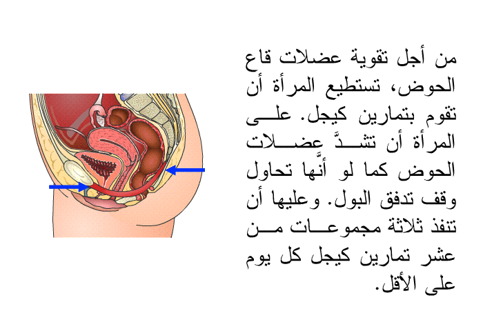 من أجل تقوية عضلات قاع الحوض، تستطيع المرأة أن تقوم بتمارين كيجل. على المرأة أن تشدَّ عضلات الحوض كما لو أنَّها تحاول وقف تدفق البول. وعليها أن تنفذ ثلاثة مجموعات من عشر تمارين كيجل كل يوم على الأقل.