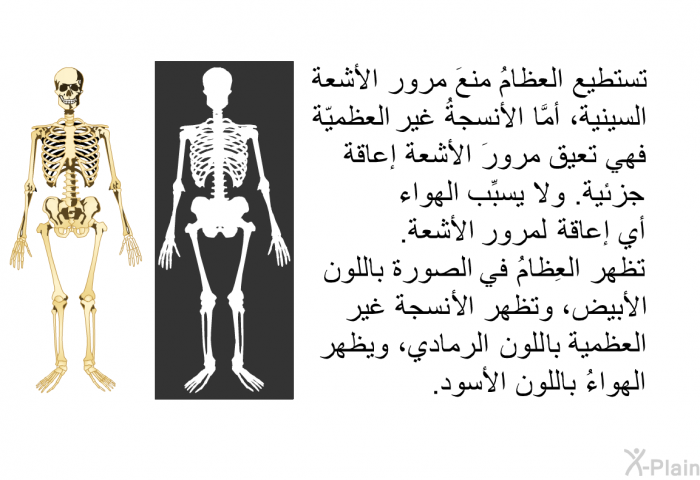 تستطيع العظامُ منعَ مرور الأشعة السينية، أمَّا الأنسجةُ غير العظميّة فهي تعيق مرورَ الأشعة إعاقة جزئية<B>. </B>ولا يسبِّب الهواء أي إعاقة لمرور الأشعة<B>. </B> تظهر العِظامُ في الصورة باللون الأبيض، وتظهر الأنسجة غير العظمية باللون الرمادي، ويظهر الهواءُ باللون الأسود<B>. </B>