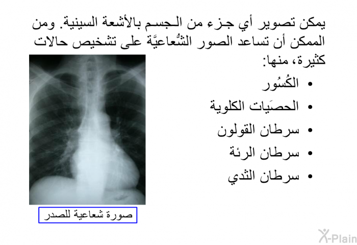 يمكن تصوير أي جزء من الجسم بالأشعة السينية<B>. </B>ومن الممكن أن تساعد الصور الشُّعاعيَّة على تشخيص حالات كثيرة، منها<B>: </B>   الكُسُور  الحصَيات الكلوية  سرطان القولون  سرطان الرئة سرطان الثدي