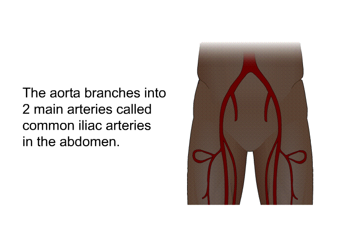 The aorta branches into 2 main arteries called common iliac arteries in the abdomen.