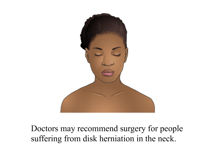 Doctors may recommend surgery for people suffering from disk herniation in the neck.