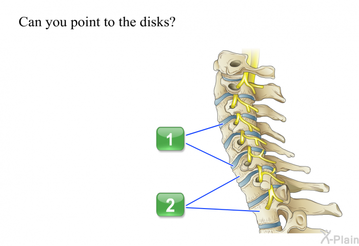 Can you point to the disks?