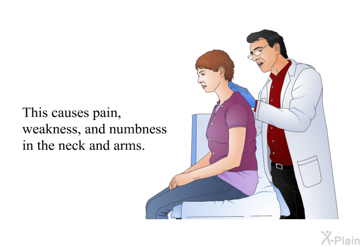 This causes pain, weakness, and numbness in the neck and arms.