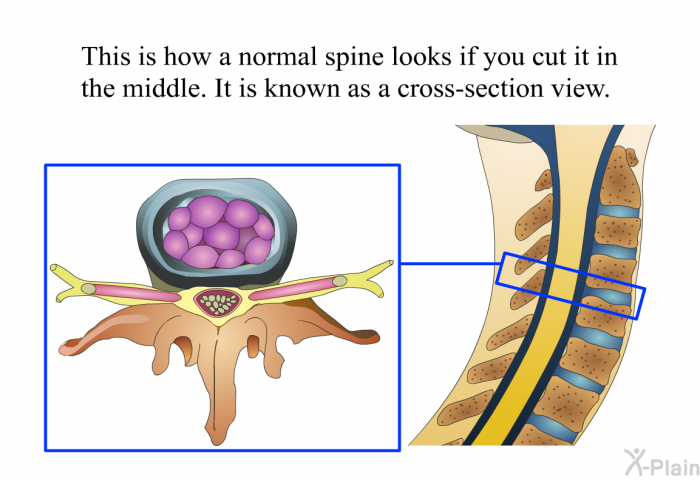 This is how a normal spine looks if you cut it in the middle. It is known as a cross-section view.