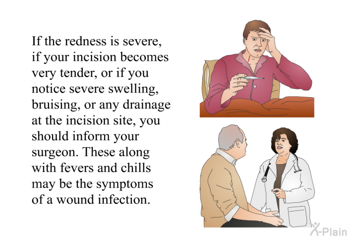 If the redness is severe, if your incision becomes very tender, or if you notice severe swelling, bruising, or any drainage at the incision site, you should inform your surgeon. These along with fevers and chills may be the symptoms of a wound infection.