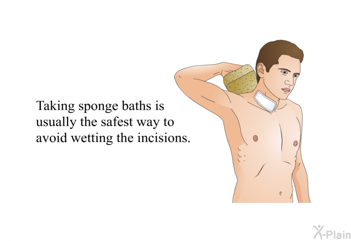 Taking sponge baths is usually the safest way to avoid wetting the incisions.