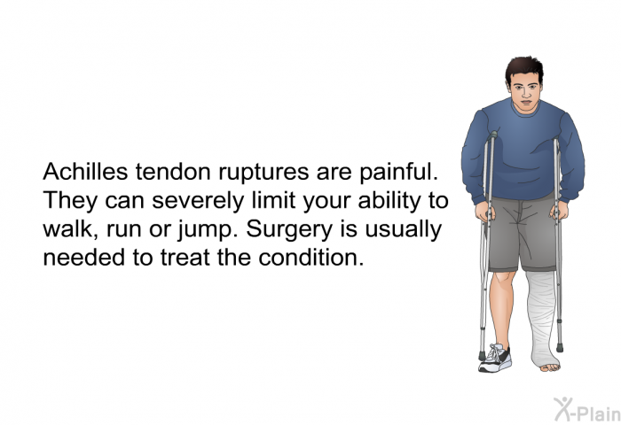 Achilles tendon ruptures are painful. They can severely limit your ability to walk, run or jump. Surgery is usually needed to treat the condition.