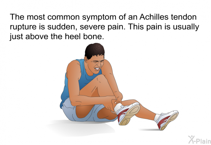 The most common symptom of an Achilles tendon rupture is sudden, severe pain. This pain is usually just above the heel bone.