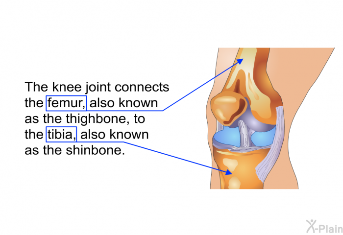 The knee joint connects the femur, also known as the thighbone, to the tibia, also known as the shinbone.