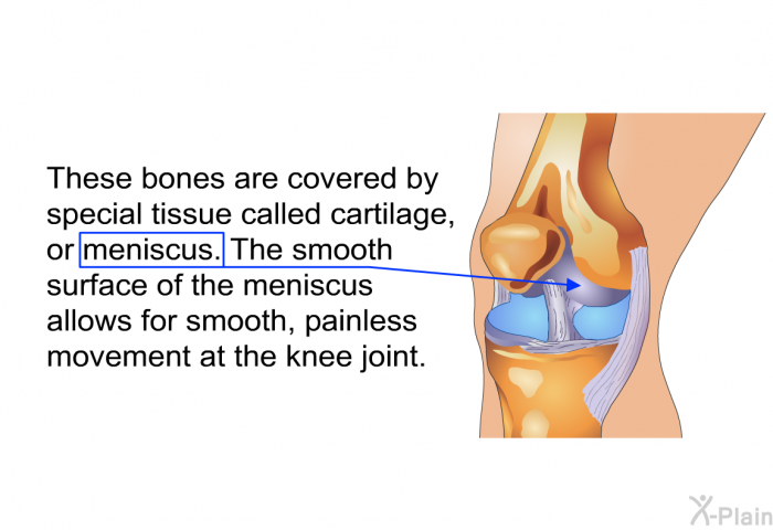 These bones are covered by special tissue called cartilage, or meniscus. The smooth surface of the meniscus allows for smooth, painless movement at the knee joint.