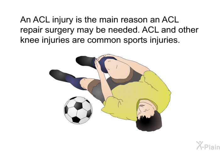 An ACL injury is the main reason an ACL repair surgery may be needed. ACL and other knee injuries are common sports injuries.
