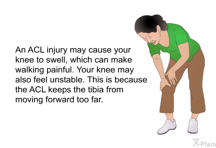 An ACL injury may cause your knee to swell, which can make walking painful. Your knee may also feel unstable. This is because the ACL keeps the tibia from moving forward too far.