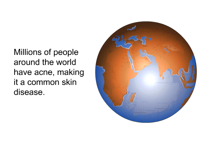 Millions of people around the world have acne, making it a common skin disease.