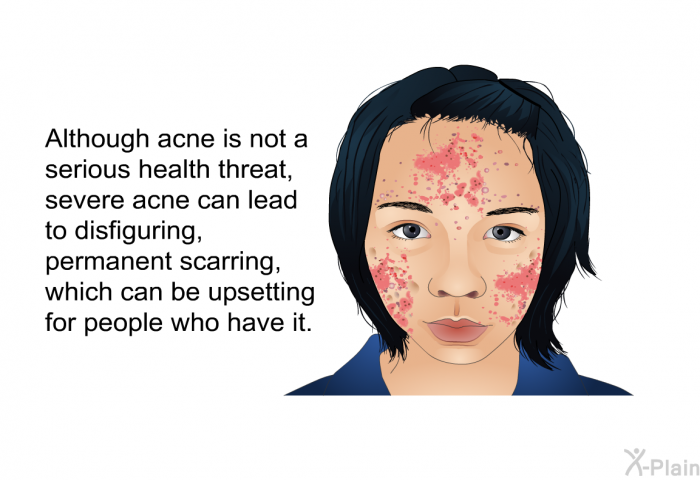 Although acne is not a serious health threat, severe acne can lead to disfiguring, permanent scarring, which can be upsetting for people who have it.