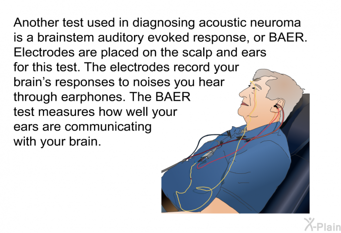 Another test used in diagnosing acoustic neuroma is a brainstem auditory evoked response, or BAER. Electrodes are placed on the scalp and ears for this test. The electrodes record your brain's responses to noises you hear through earphones. The BAER test measures how well your ears are communicating with your brain.