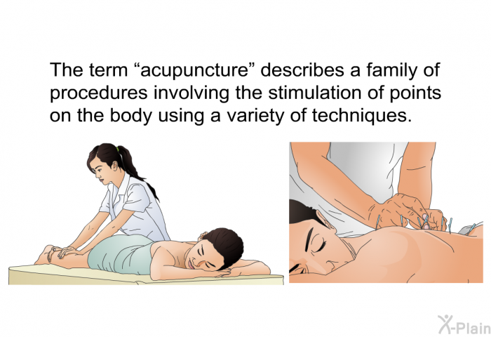 The term “acupuncture” describes a family of procedures involving the stimulation of points on the body using a variety of techniques.