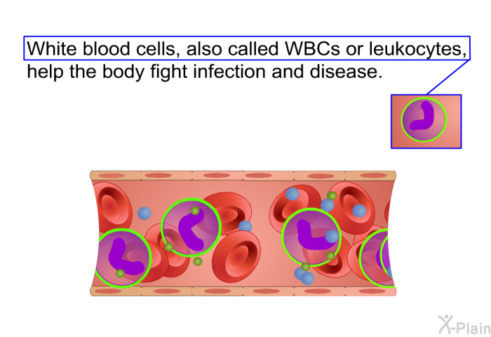 White blood cells, also called WBCs or leukocytes, help the body fight infection and disease.