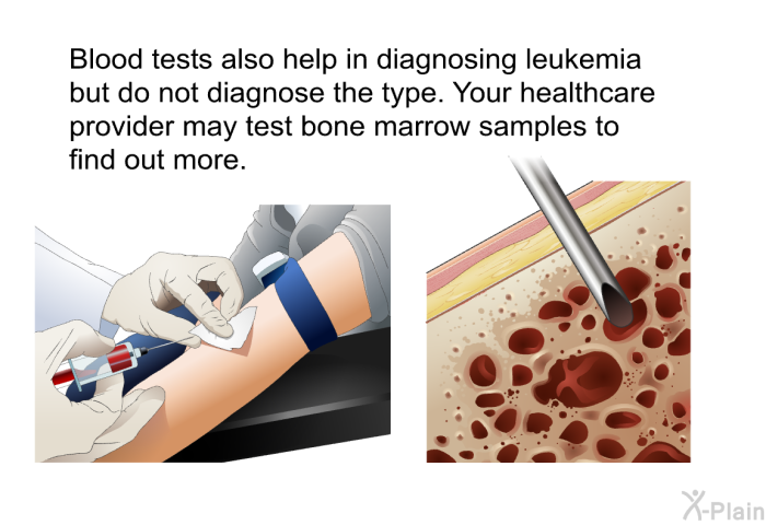 Blood tests also help in diagnosing leukemia but do not diagnose the type. Your healthcare provider may test bone marrow samples to find out more.