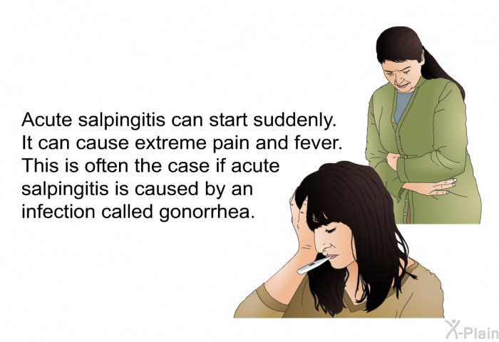 Acute salpingitis can start suddenly. It can cause extreme pain and fever. This is often the case if acute salpingitis is caused by an infection called gonorrhea.