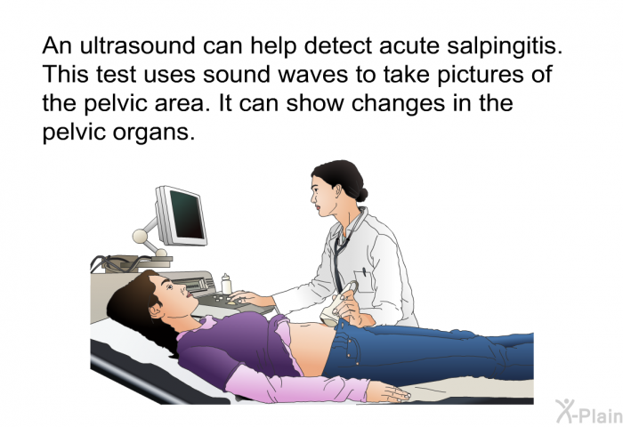 An ultrasound can help detect acute salpingitis. This test uses sound waves to take pictures of the pelvic area. It can show changes in the pelvic organs.