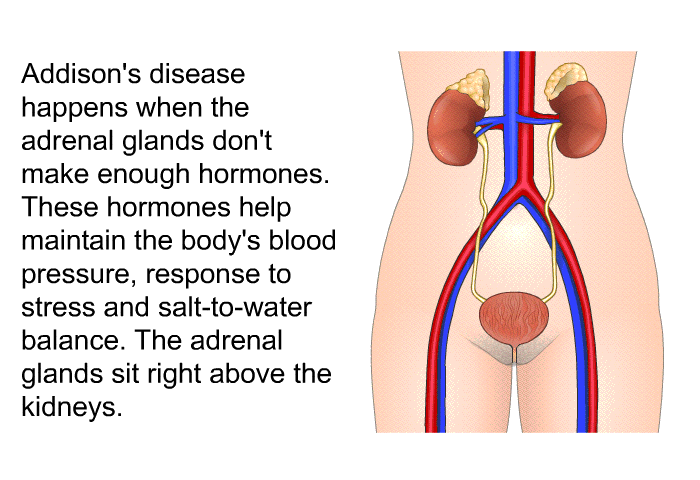 Addison's disease happens when the adrenal glands don't make enough hormones. These hormones help maintain the body's blood pressure, response to stress and salt-to-water balance. The adrenal glands sit right above the kidneys.